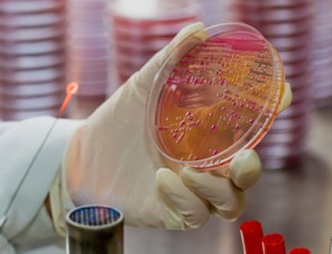 diagnosis of sepsis