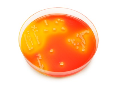 Successful management of a Bacillus cereus CRBSI outbreak