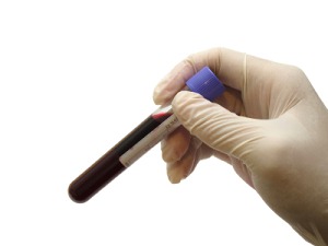 phlebotomy